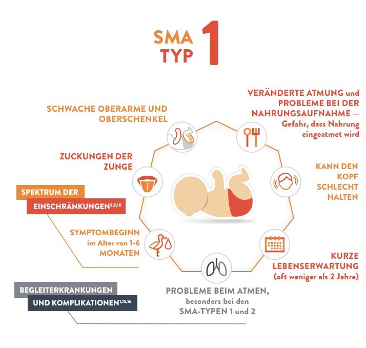 SMA bei Kindern